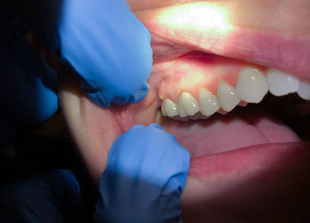 Best Emergency Treatment for Jaw Pain or Injury in Red Rock, AZ